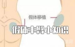 丰臀有什么好处？会有异物感吗