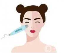 光子嫩肤后会使人看起来更年轻吗？