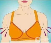 可以不切除副乳吗？会有影响吗