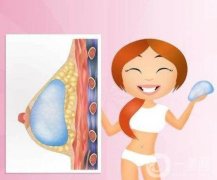 复合丰胸效果如何？和假体隆胸哪个好