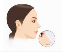 鼻综合的麻醉安全如何？