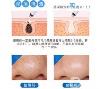 超微小气泡可能产生哪些副作用？