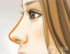 鼻部整形手术的方法有哪些？