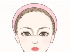 达拉斯鼻整形术和普通鼻整形术的区别