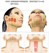 超声波手术后如何做好补水