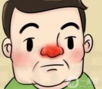 如何降低酒渣鼻的风险