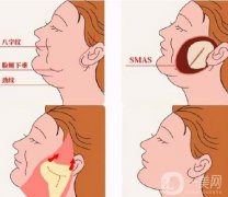 哪些人适合电波拉皮，效果能维持多久？