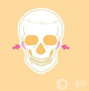 截骨后面部会下垂吗？