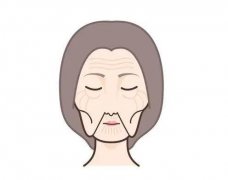 电波拉皮除皱有什么优点？