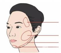 电波拉皮不安全吗，安全性如何