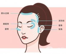 对电波拉皮价格有影响的因素有哪些