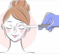 超声刀的副作用是什么？哪些人不适合