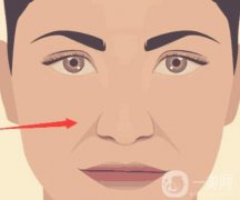 常用的去除法令纹的方法有哪些？