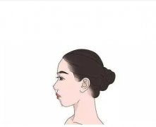 垫鼻基底的常用方法有哪些？能法令纹吗