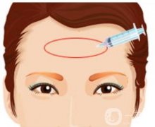 额头填充自体脂肪有哪些优势