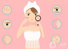 激光去除红血丝有什么好处？痛吗