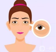 激光去除黑眼圈的优点有哪些？