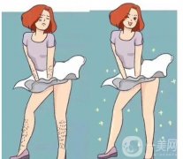 光子脱毛的原理是什么，有哪些注意事项