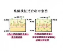 果酸换肤有什么危害？