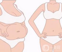 抽脂术后腹部凹凸不平可以修复吗？