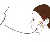 为什么线雕后不能立即敷面膜？