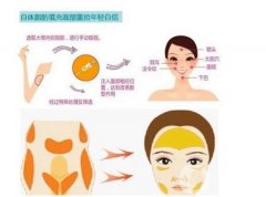 自体脂肪填充后要注意什么？