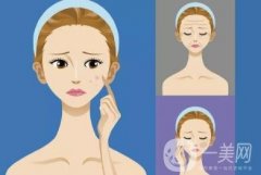 彩光嫩肤可以收缩毛孔吗，要做几次