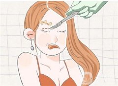 开眼角的肿胀什么时候能消退？