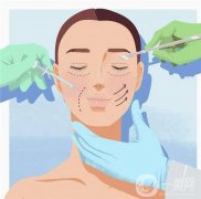 埋线双眼皮需要拆线吗？如何拆