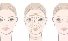 除皱有哪些方法和注意事项