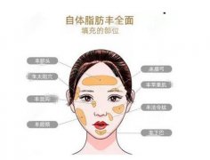 哪些觉得了自体脂肪填充泪沟的维持时间