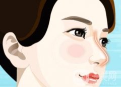 膨体鼻整形术有什么优点？