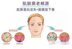 热玛吉后需要多长时间才能恢复