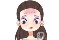 如何使用激光鲜红斑痣