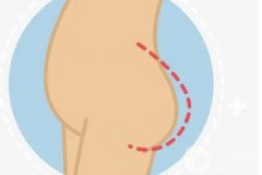 假臀宽可以吗？