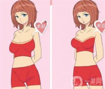 隆胸后手感是硬硬的吗？有哪些注意事项