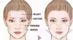 切眉手术后要注意什么？切眉后的疤痕如何处理