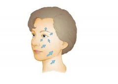 去除川纹的方法有哪些