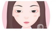 如何缩短开眼角后疤痕消失的时间？