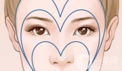 切眉失败了怎么办？可以做两次吗