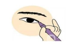 水泡眼双眼皮的手术方法