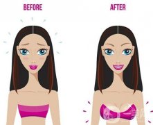 隆胸的危害有哪些？哪些女性不适合