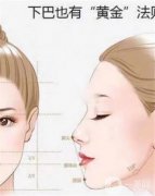 隆下巴什么时候可以恢复？