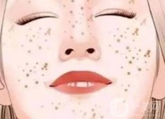 如何酒渣鼻，可以吗