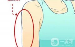 手臂吸脂有效吗，有什么优点