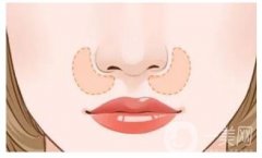 鼻孔缩小手术安全吗？有什么好处