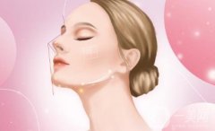 矫正宽鼻翼的手术方法及步骤