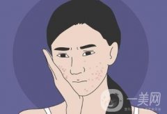 哪些皮肤问题激光美容可以解决