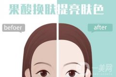 果酸换肤的功效和优点有哪些？
