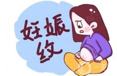 激光去除妊娠纹的优势有哪些